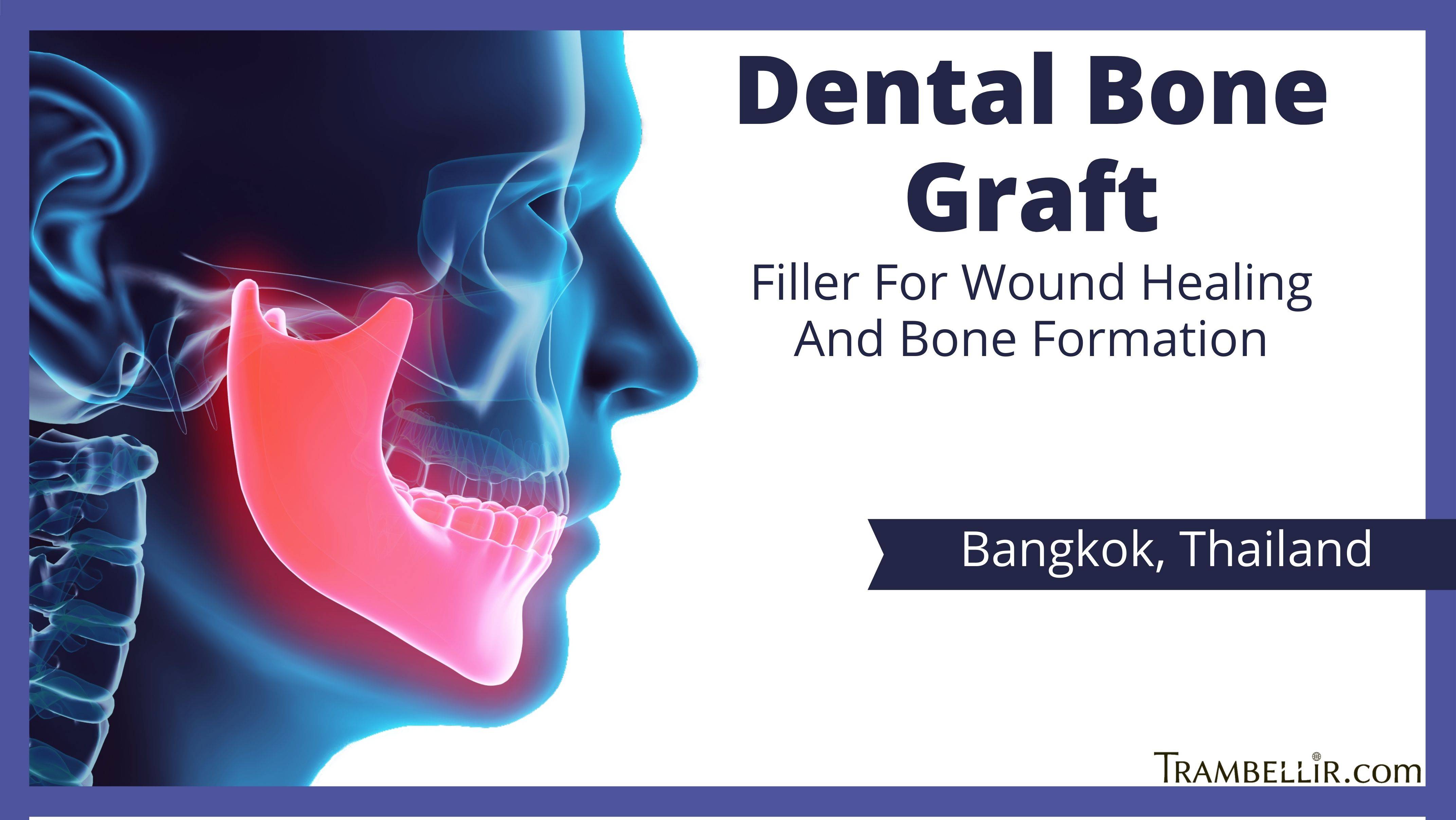 Dental Bone Graft (Filler For Wound Healing And Bone Formation
