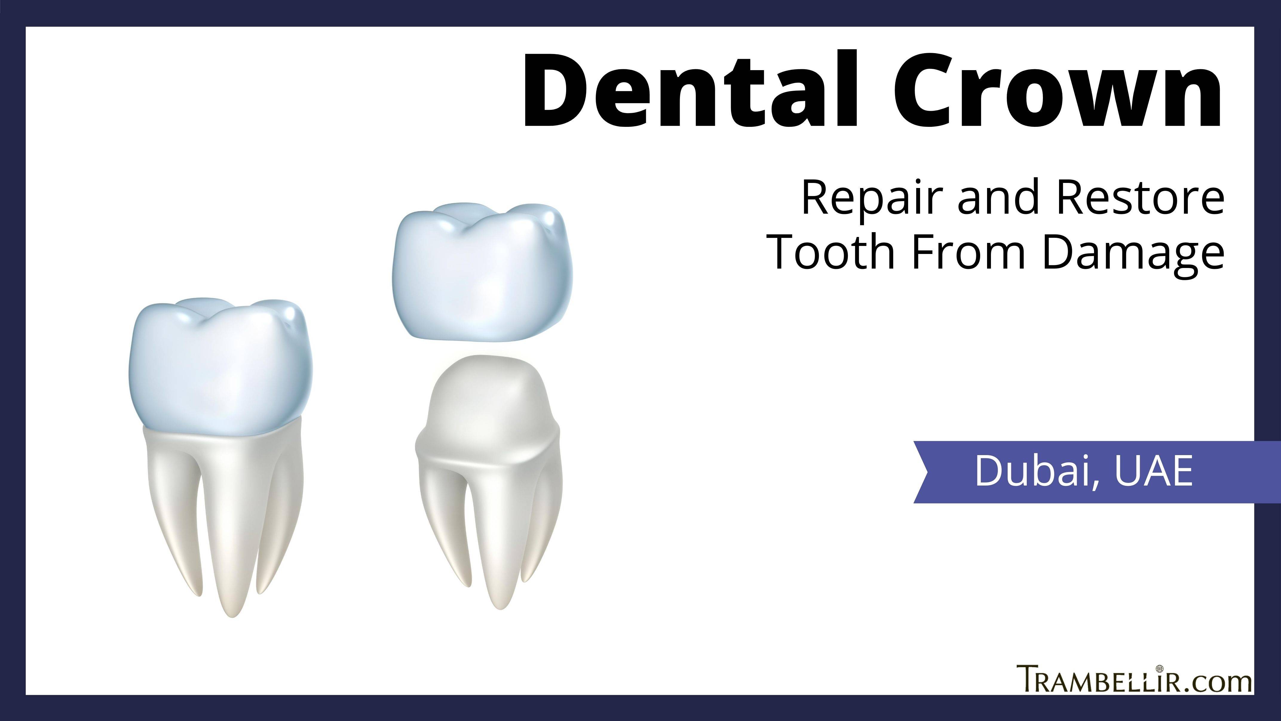 Dental Crown (Repair and Restore Tooth From Damage) Trambellir