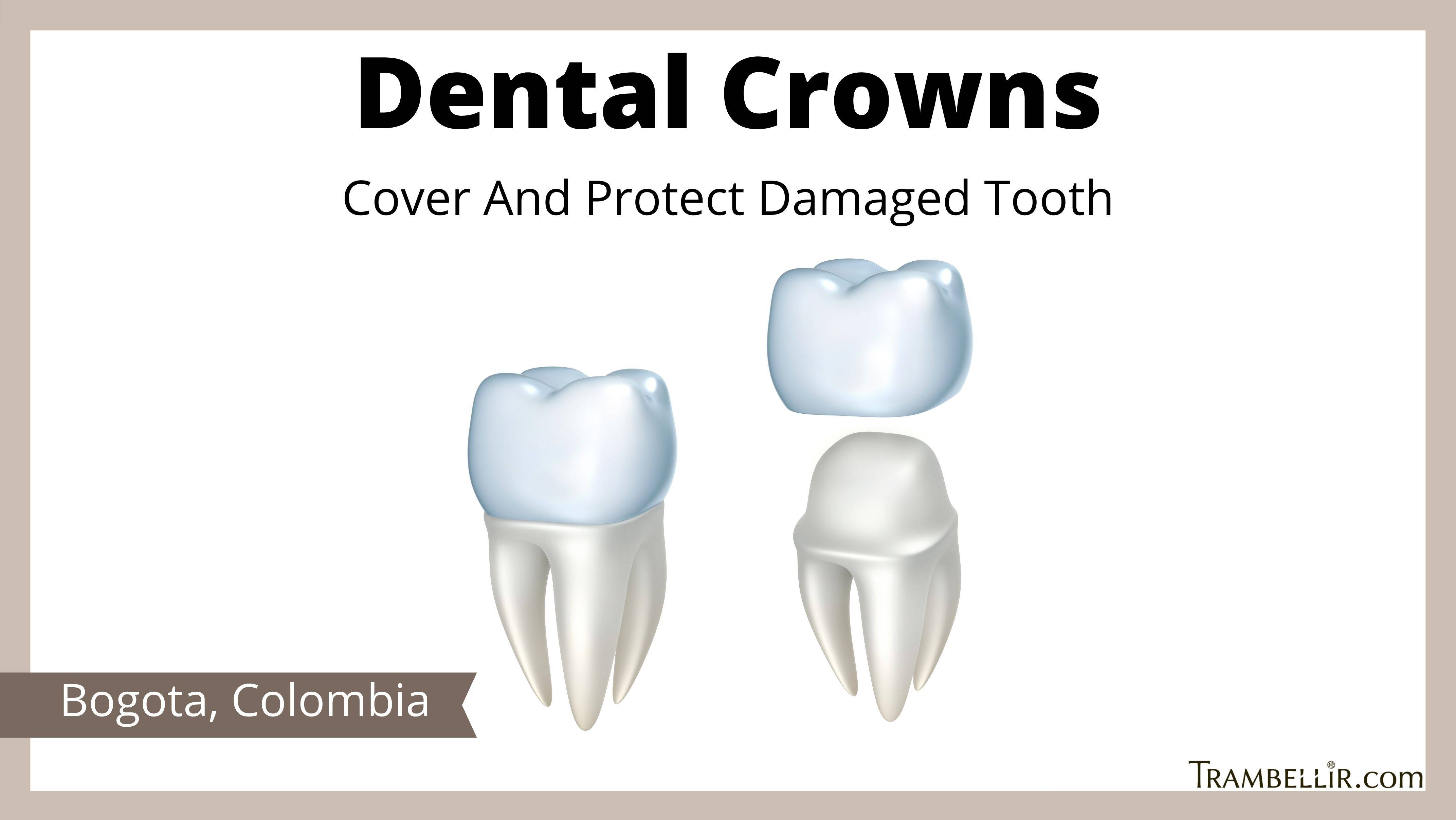 Dental Crowns (Cover And Protect Damaged Tooth) Trambellir