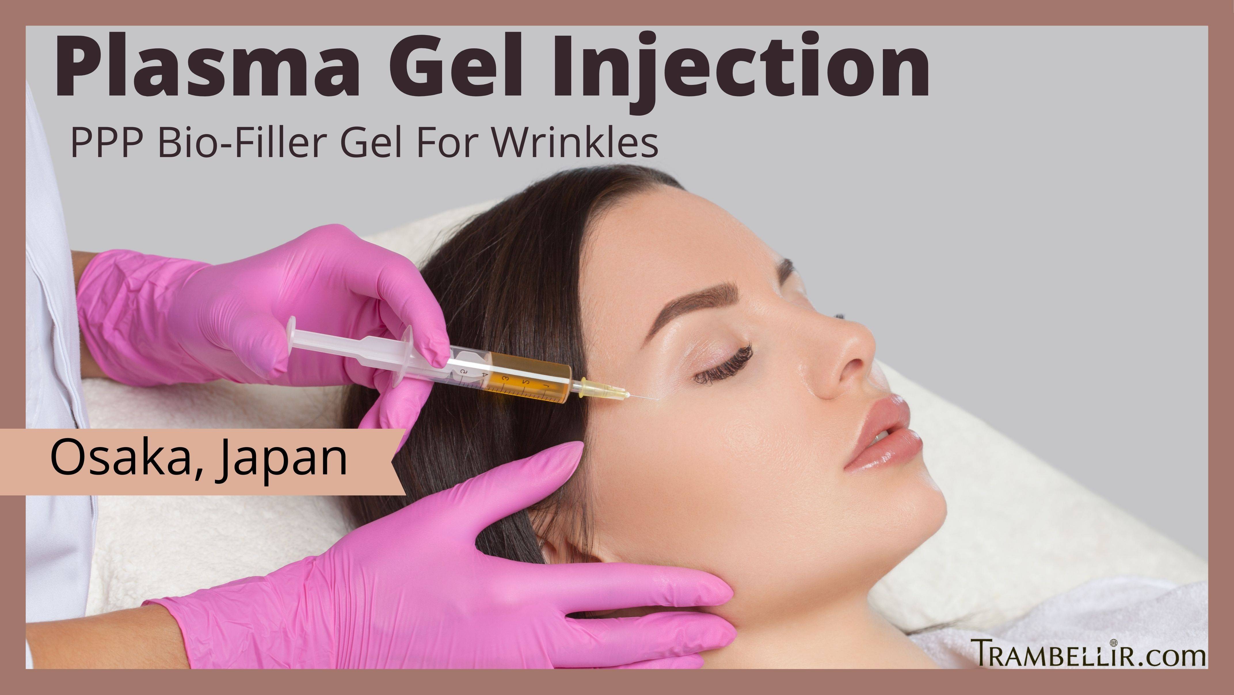 gel excite 9 color injection