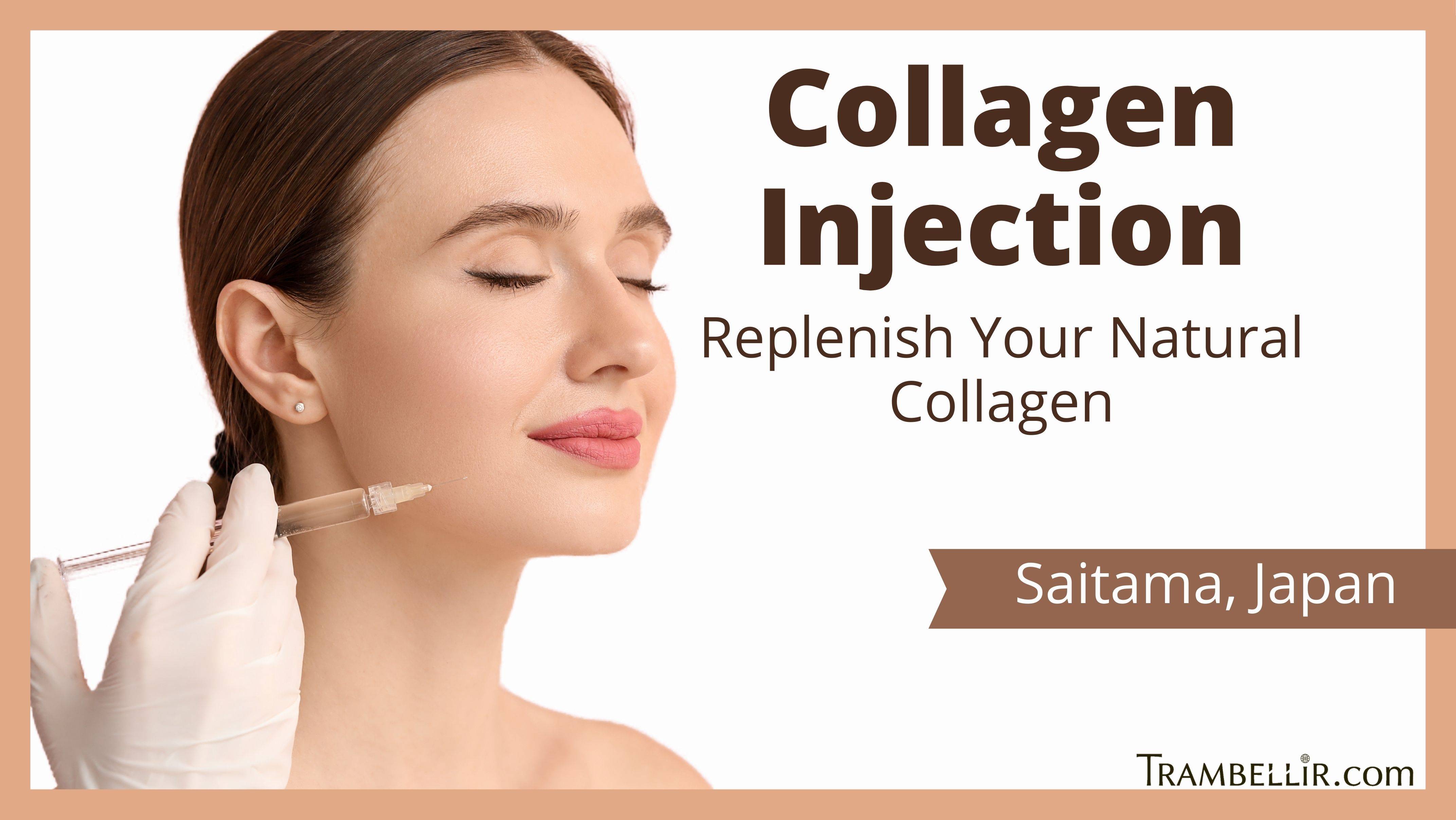 How Long Do Collagen Injections Last – DNMIO