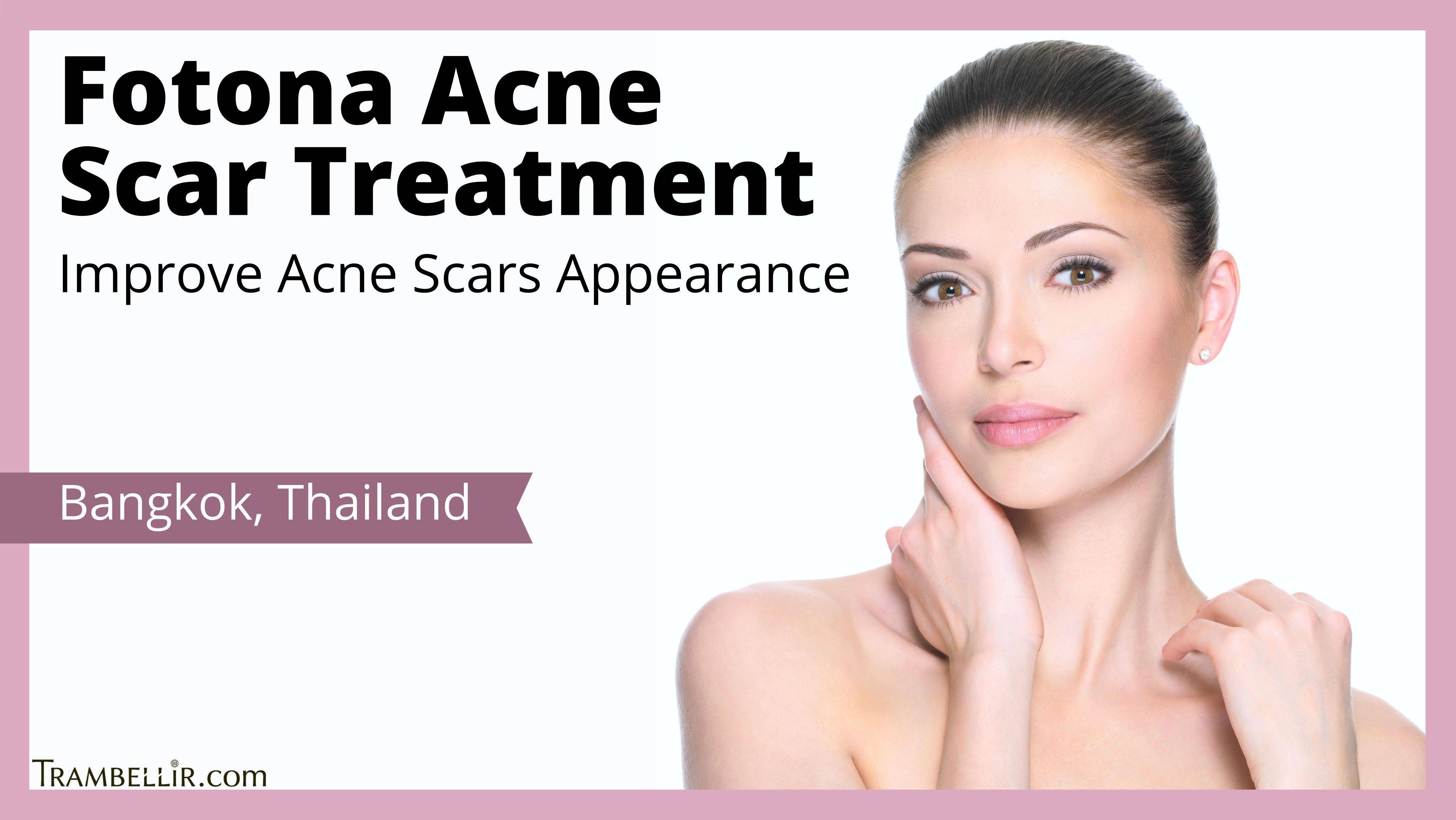 Fotona Acne Scar Treatment (Improve Acne Scars Appearance) Trambellir