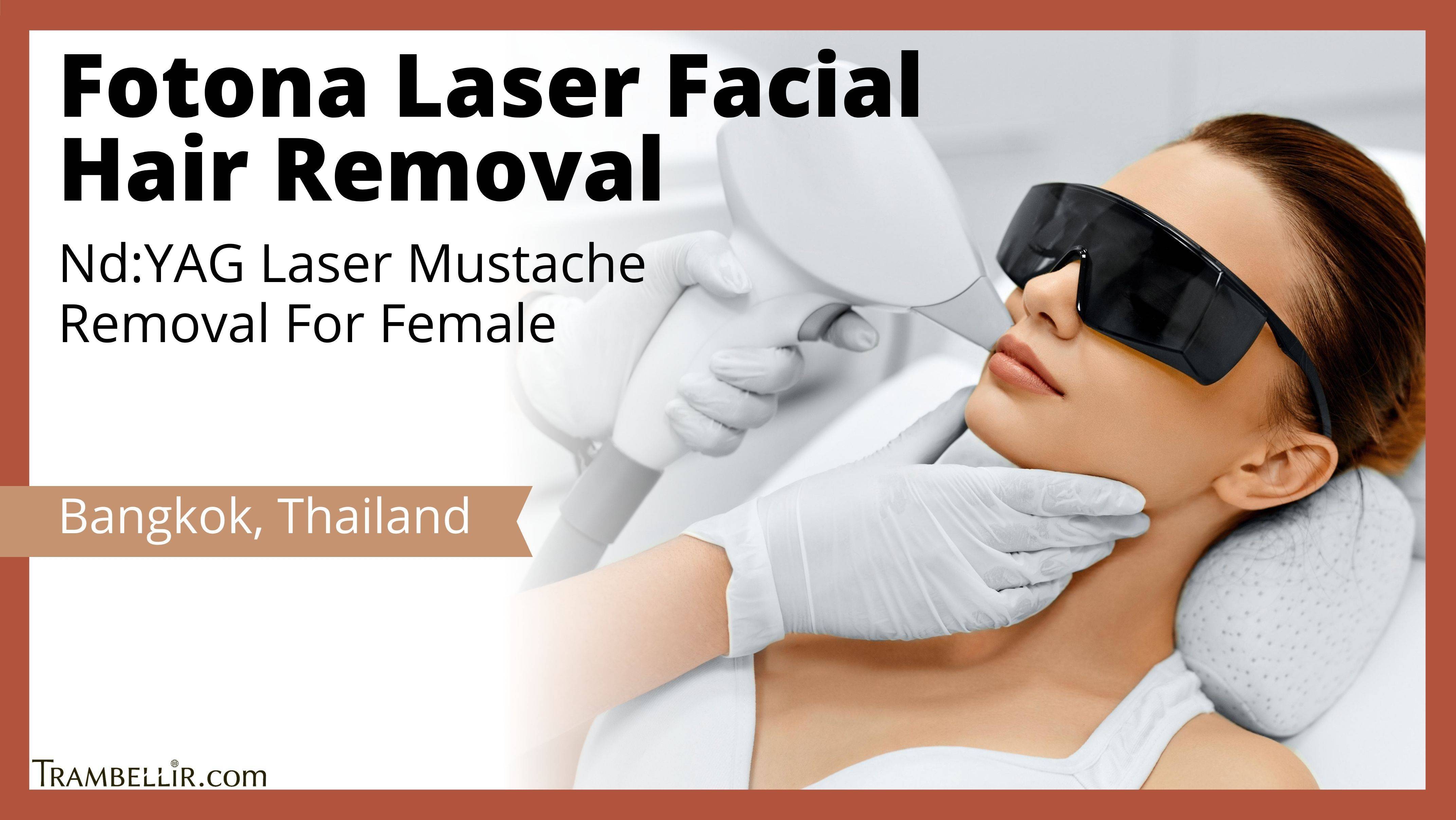Fotona Laser Facial Hair Removal (NdYAG Laser Mustache Removal For Female) Trambellir